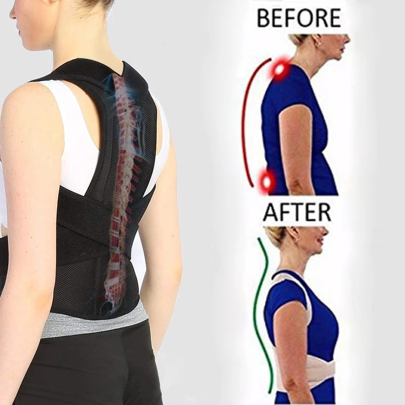 AlignBack Posture Corrector for hunchback: Effective Brace for Correcting Poor Posture & Relieving Hunchback Transform Your Posture