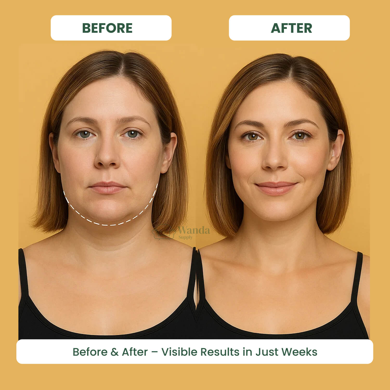 Double Chin Reducing Massager - Facial Sculpting Tool for Contoured Jawline
