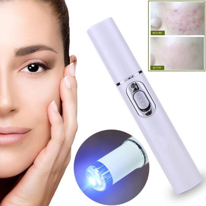 Blue Light Laser Pen for Spots, Scars &amp; Tattoos