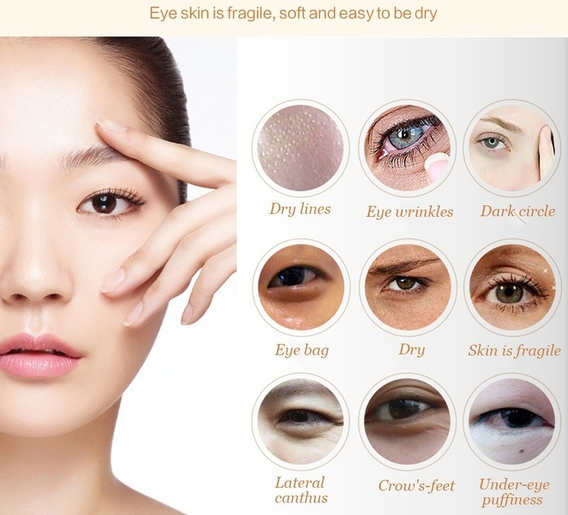 anti-wrinkle-cream 