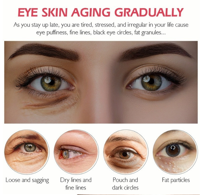 anti-wrinkle-cream 