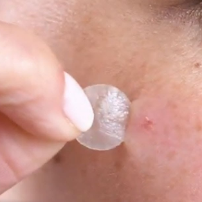 pimple-patches