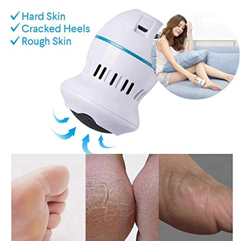 Pedi Vac Electric Callus Remover - Portable Dead Skin Foot File