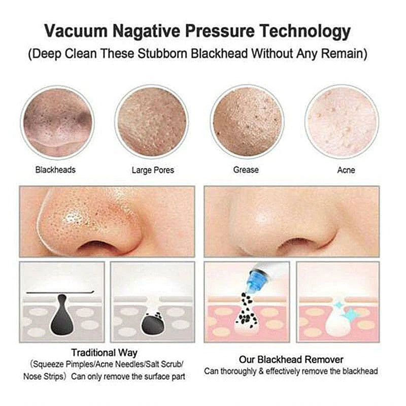 4 Heads T-zone Electric Acne Remover Pore Suction